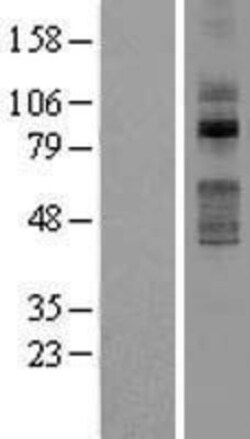 Novus Biologicals TLK2 Overexpression Lysate 0.1 mg | Buy Online | Novus Biologicals&trade; | Fisher Scientific