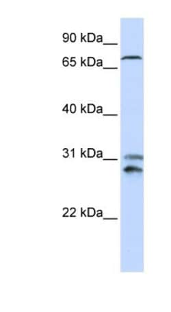 TLK2 Antibody, Novus Biologicals:Antibodies:Primary Antibodies