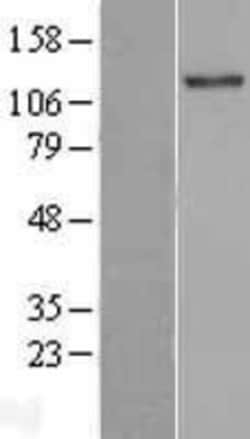 Novus Biologicals™ TLL2 Overexpression Lysate