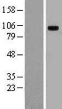 Novus Biologicals&trade;&nbsp;TLR10 Overexpression Lysate