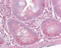 TLR1 Antibody, Novus Biologicals 0.025mg; Unlabeled:Antibodies, Polyclonal