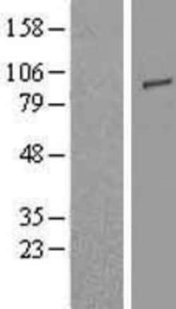 Novus Biologicals™ TLR2 Overexpression Lysate