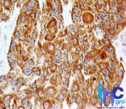 TLR2 Antibody (67N8F8), Novus Biologicals:Antibodies:Primary Antibodies