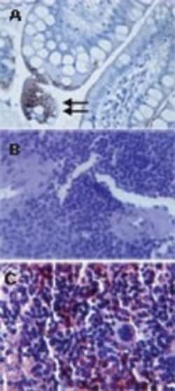TLR3 Antibody (40C1285.6) - BSA Free, Novus Biologicals:Antibodies:Primary