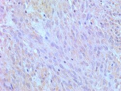 TLR4 Antibody (76B357.1) - BSA Free, Novus Biologicals:Antibodies:Primary