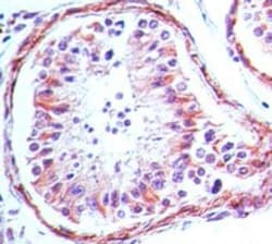 TLR4 Antibody (76B357.1) - BSA Free, Novus Biologicals:Antibodies:Primary