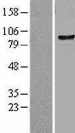 Novus Biologicals™ TLR6 Overexpression Lysate