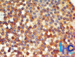 TLR6 Antibody (86B1153.2) - BSA Free, Novus Biologicals:Antibodies:Primary