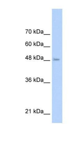 TLR6 Antibody, Novus Biologicals 100&mu;L; Unlabeled:Antibodies, Polyclonal