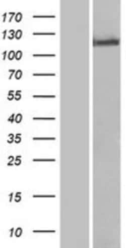 Novus Biologicals&trade;&nbsp;TLR8 Overexpression Lysate