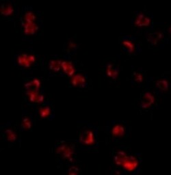 TLR8 Antibody - BSA Free, Novus Biologicals 0.1mg; Unlabeled:Antibodies,