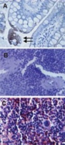 Novus Biologicals TLR Screening Antibody Pack 10 vials:Antibodies