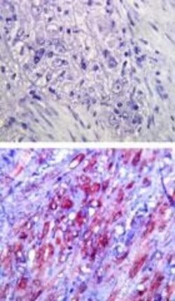 Novus Biologicals TLR (Cell Surface) Screening Antibody Pack 6 vials:Antibodies