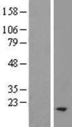Novus Biologicals&trade;&nbsp;TM2D2 Overexpression Lysate