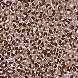 TM2D2 Antibody, Novus Biologicals 0.1mL; Unlabeled:Antibodies, Polyclonal
