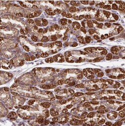TM2D3 Antibody, Novus Biologicals 0.1mL; Unlabeled:Antibodies, Polyclonal