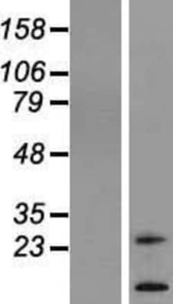 Novus Biologicals™ TM4SF20 Overexpression Lysate