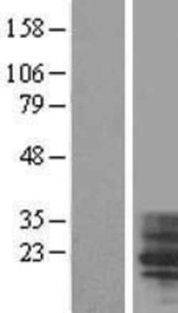 Novus Biologicals™ TM4SF4 Overexpression Lysate