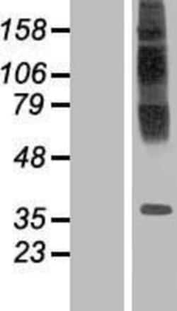 Novus Biologicals&trade;&nbsp;TM6SF1 Overexpression Lysate