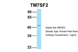 TM7SF2 Antibody, Novus Biologicals:Antibodies:Primary Antibodies