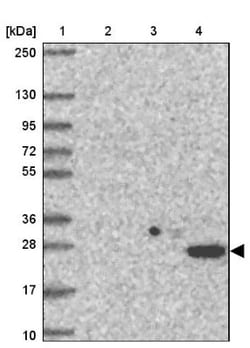 TM9SF1 Antibody, Novus Biologicals 0.1mL; Unlabeled:Antibodies, Polyclonal