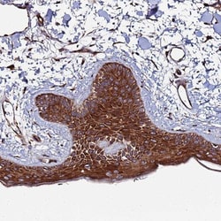 TMC2 Antibody, Novus Biologicals:Antibodies:Primary Antibodies