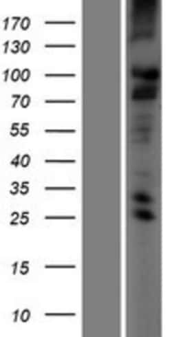 Novus Biologicals™ TMC2 Overexpression Lysate