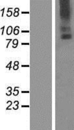 Novus Biologicals&trade;&nbsp;TMC6 Overexpression Lysate