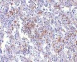 TMC6 Antibody - BSA Free, Novus Biologicals:Antibodies:Primary Antibodies