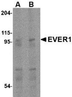 TMC6 Antibody - BSA Free, Novus Biologicals 0.025 mg, Unconjugated:Antibodies,