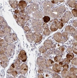 TMCC1 Antibody, Novus Biologicals 0.1mL; Unlabeled:Antibodies, Polyclonal