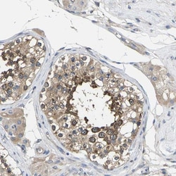 TMCC2 Antibody, Novus Biologicals:Antibodies:Primary Antibodies