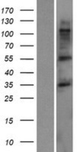 Novus Biologicals&trade;&nbsp;TMCC3 Overexpression Lysate