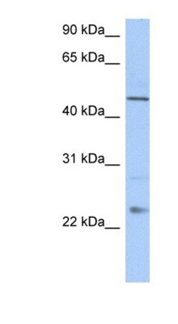 TMCO1 Antibody, Novus Biologicals 0.05mg; Unlabeled:Antibodies, Polyclonal