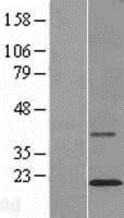 Novus Biologicals&trade;&nbsp;TMCO2 Overexpression Lysate
