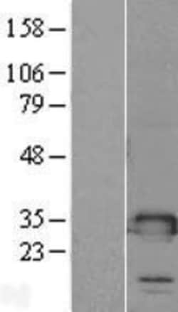 Novus Biologicals&trade;&nbsp;TMED1 Overexpression Lysate