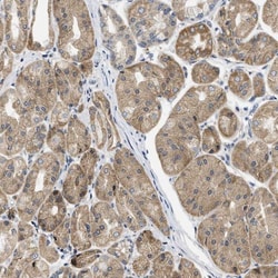 TMED1 Antibody, Novus Biologicals 0.1mL; Unlabeled:Antibodies, Polyclonal