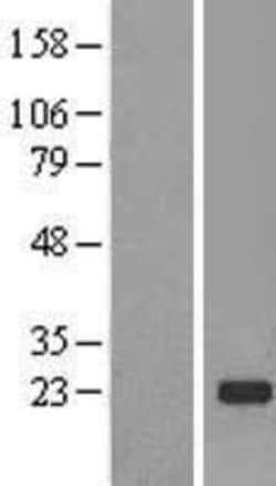 Novus Biologicals™ TMED2 Overexpression Lysate