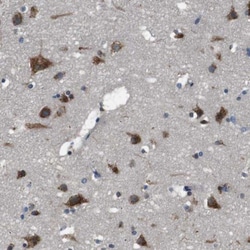 TMED2 Antibody, Novus Biologicals:Antibodies:Primary Antibodies