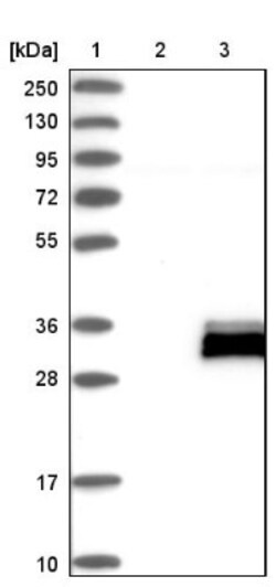 TMED6 Antibody, Novus Biologicals 0.1 mL | Buy Online | Novus Biologicals | Fisher Scientific