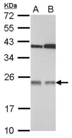 TMED7 Antibody, Novus Biologicals 0.1 mL | Buy Online | Novus Biologicals | Fisher Scientific