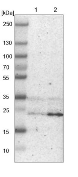 TMED9 Antibody, Novus Biologicals 0.1mL; Unlabeled:Antibodies, Polyclonal
