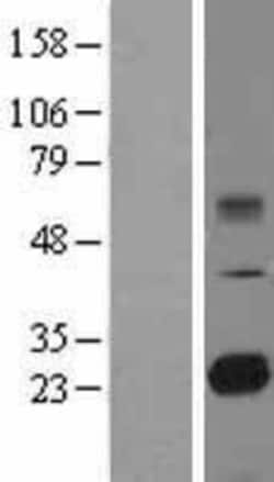 Novus Biologicals™ TMED9 Overexpression Lysate