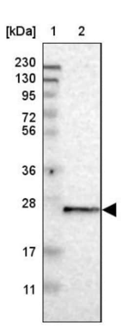 TMED9 Antibody, Novus Biologicals 0.1mL; Unlabeled:Antibodies, Polyclonal