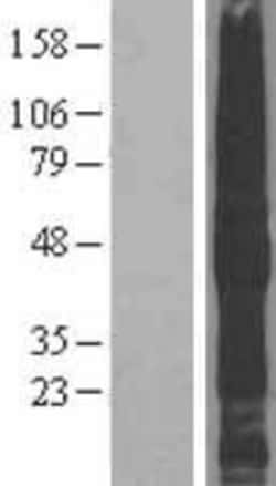 Novus Biologicals&trade;&nbsp;TMEFF2/Tomoregulin-2 Overexpression Lysate