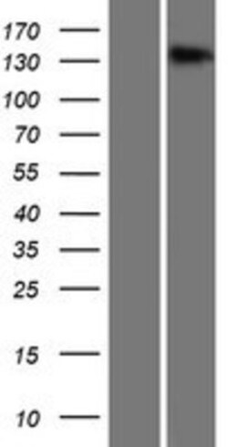 Novus Biologicals&trade;&nbsp;TMEM1 Overexpression Lysate