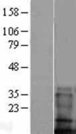 Novus Biologicals&trade;&nbsp;TMEM100 Overexpression Lysate