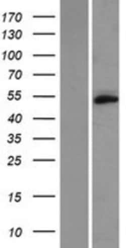 Novus Biologicals™ TMEM102 Overexpression Lysate