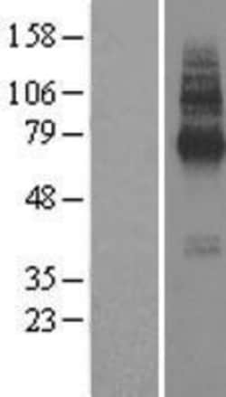 Novus Biologicals&trade;&nbsp;TMEM104 Overexpression Lysate