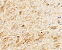 TMEM106A Antibody - BSA Free, Novus Biologicals:Antibodies:Primary Antibodies